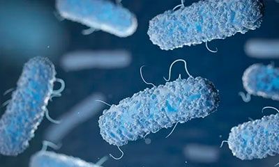 eliminación y control de legionella