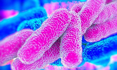 eliminación y control de legionella