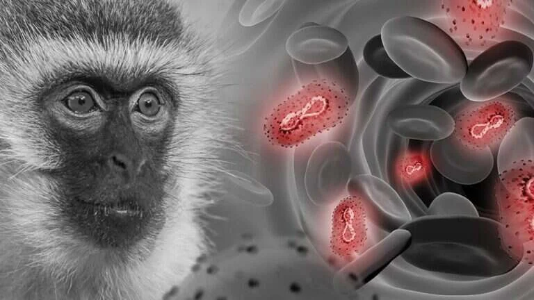 virus del mono