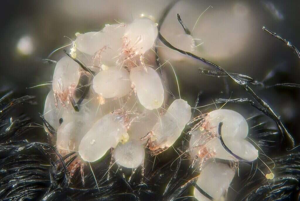 Grupo numeroso de ácaros del polvo agarrados a las fibras de un tejido, visto al microscopio