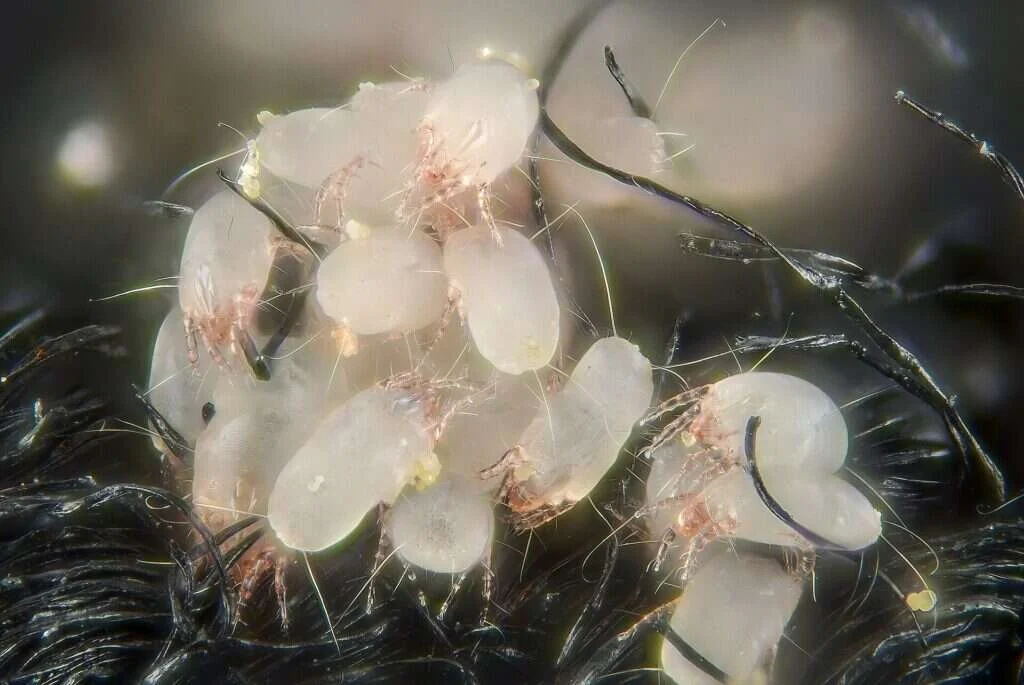 Grupo numeroso de ácaros del polvo agarrados a las fibras de un tejido, visto al microscopio