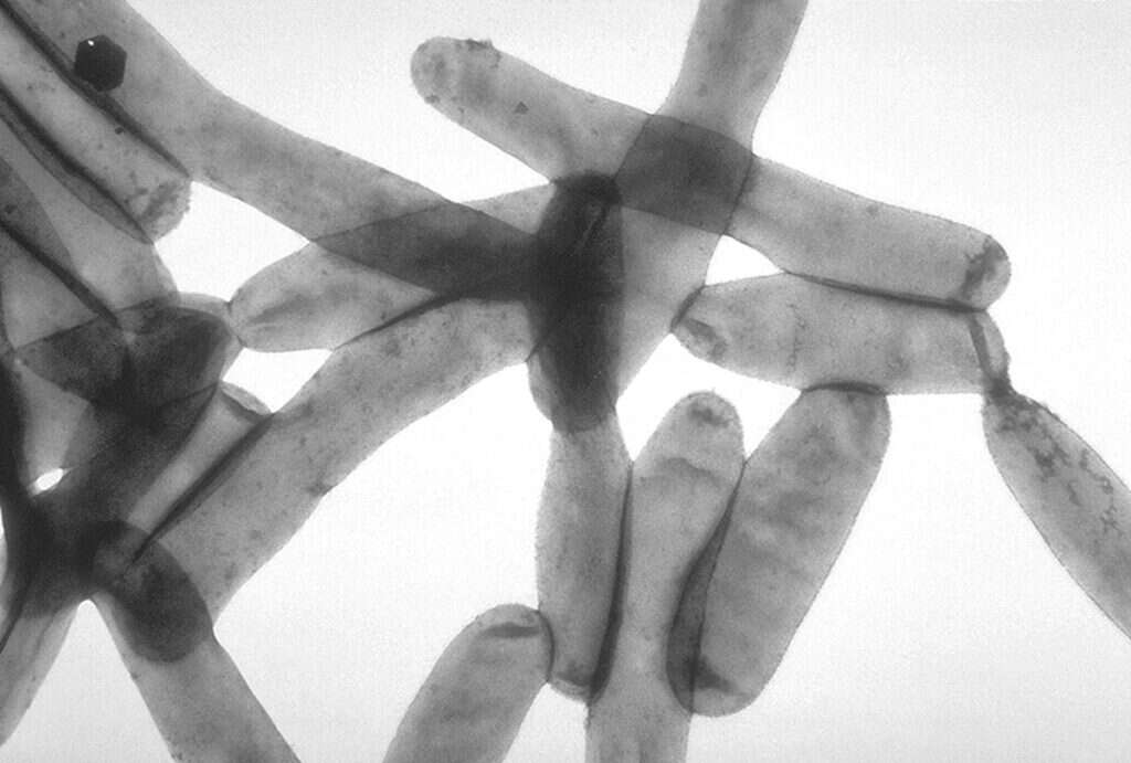 Micrografía de Legionella pneumophila, la bacteria que se multiplica en el agua entre 20 y 45 grados